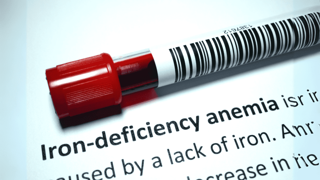Iron Deficiency Anemia / Iron | Complete Details / the metal times / loha / steel